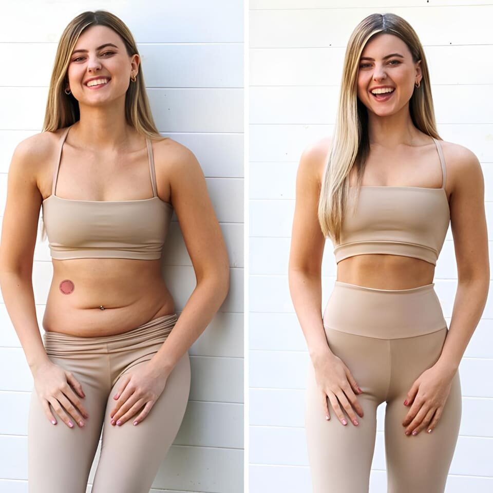 Luxarise Patches image